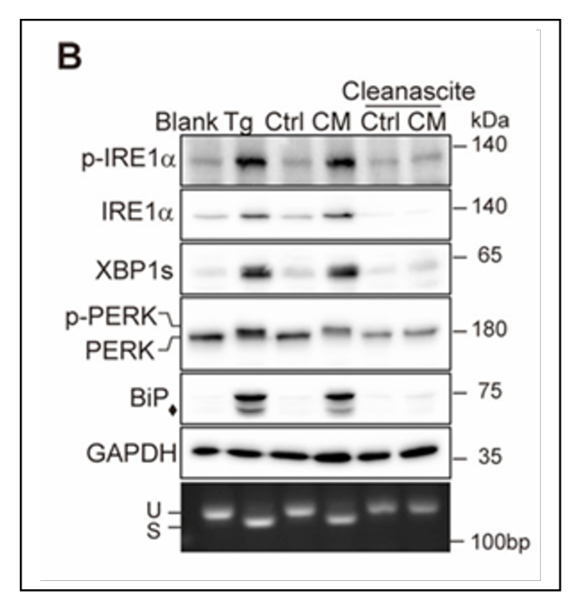 Cleanascite™ Cited In Study of Lipid Biology in Endoplasmic Reticulum Stress